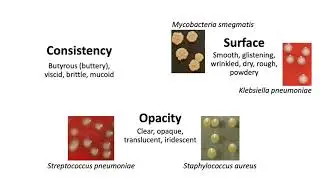 Level 2 Microbiology & Immunology | Microbiological Examination of River Water (Colony Morphology)