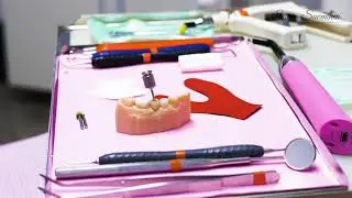 Digital implant workflow