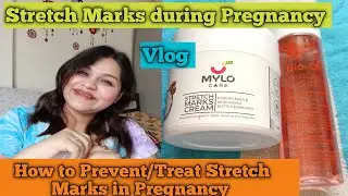 Stretch Marks during Pregnancy | How to Prevent & Treat Stretch Marks in Pregnancy | New Vlog