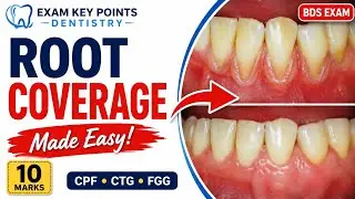 Procedure for Coverage of Denuded Roots|Periodontal Plastic Surgery Explained in Easy English