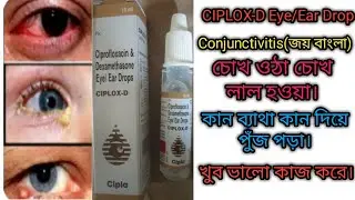 Ciplox-D Eye/Ear Drops use dosage and side effects full review.#rajbangshi medical#medicine review.