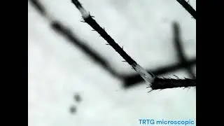 Magnification of Aedes Mosquito