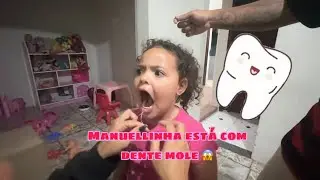MANUELLA ESTÁ COM DENTE MOLE, SERÁ QUE ELA CONSEGUIU ARRANCAR? 
