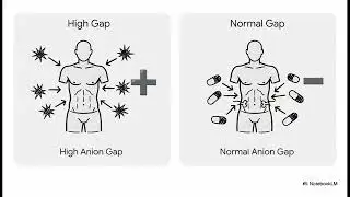 Metabolic Acidosis (Step 1) | Anion Gap Decision Tree Masterclass