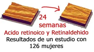 Acido retinoico y Retinaldehido antes y despu&eacute;s