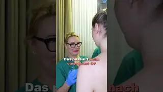 Was passiert in den ersten Momenten nach einer Brust-OP? 🌟#drberkei #brustop #Breastaugmentation