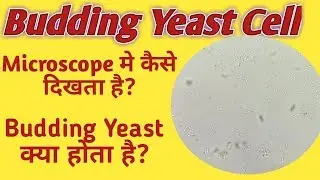 Budding Yeast cells in urine | Budding Yeast cell under microscope | What is budding Yeast cell