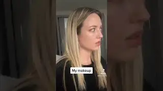 SKIN PICKERS BE LIKE 😂 the joys of #dermatillomania