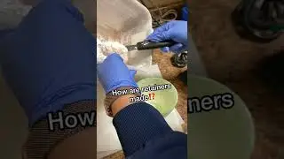 How retainers are made? Tooth Time Family Dentistry New Braunfels Texas