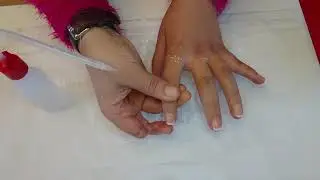 Super Realistic Silicone Prosthetic Fingers. So real you wouldn't know the difference. SkinFeel&trade;