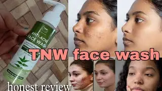 The natural wash Anti Acne face wash | 100% pure ayurvedic | Best facewash for acne & pimples