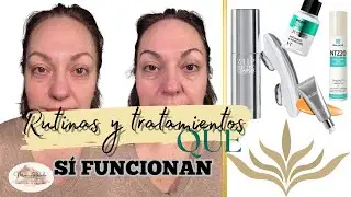 Flacidez, firmeza y manchas : Tratamientos reales que SÍ DAN RESULTADOS
