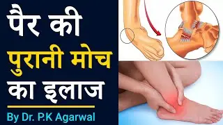 यह उपाय करें और पाएं पुरानी से पुरानी अंदरुनी चोट, सूजन से आराम Dr P.K Agarwal - Orthopedic Surgeon