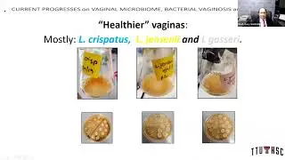 A discussion on: Current progresses on vaginal microbiome, bacterial vaginosis and biofilms