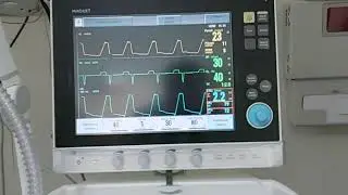 Workshop 17 How to apply Expiratory hold or pause? In MAQUET (SERVO I )  Auto PEEP mechanical ventil