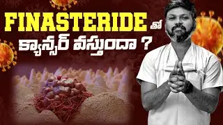 #AskDrJohnWatts | FINASTERIDE తో క్యాన్సర్ వస్తుందా ? | Hair Specialist Explains