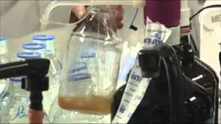 Risques alimentaires... 50 r&eacute;ponses &agrave; conna&icirc;tre.flv