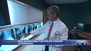 New guidelines in place for colon cancer screenings