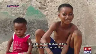 Bleached babies: JoyNews hotline documentary explores the extreme cost of beauty