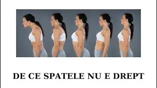 De ce spatele nu este DREPT www.kinestart.md