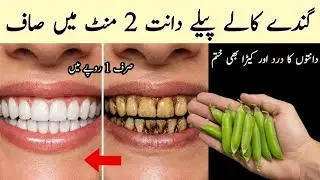 just in 1 rupee will make dirty, rotten, yellow teeth shine like pearls 😱Teeth whitening remedy