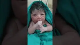 Lovely newborn baby 🐥🐥🐥   #shorts #viralvideo #yt #ytshorts #cute #baby #newborn #viralvideo