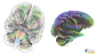 Anatom&iacute;a aplicada y concepto de redes neuronales en relaci&oacute;n a las crisis epil&eacute;pticas