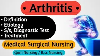 Arthritis || Arthritis In Hindi || Medical Surgical Nursing Lecture || Nursing Notes