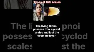Types of fish scales #tensiongonenotes #fishscaleshorts