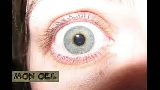 Mon Oeil