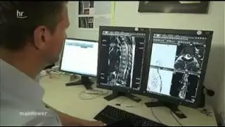 Syringomyelie