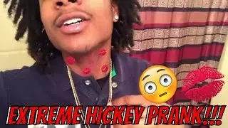 EXTREME HICKEY PRANK ON GIRLFRIEND!!!