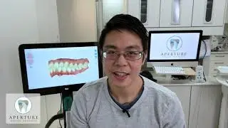 What is iTero? How is it Used in Dental Settings?