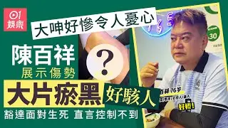 【01秒看娛樂】陳百祥血管爆了展示傷勢大片瘀黑好駭人　看淡生死不排斥安樂死｜01娛樂｜陳百祥｜香港明星｜香港藝人