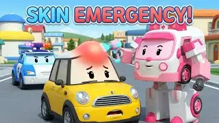 Skin Care Safety! 🚑 Don't Touch That Pimple! | Robocar POLI Rescue Team | Kids SafetyLessons