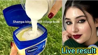 ভাইরাল দ&zwnj;ই র ফেসপ্যাক 5 মিনিট ব্যবহার করে দেখুন/Viral Dahi Face Pack😯Homemade Dahi Mask ForGlowing