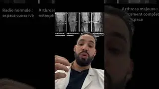 Les techniques d&rsquo;imagerie : la radiographie #pass #las #medecine #science #education
