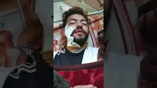 قنبلة ضحك بسبب البنج هتموت من الضحك بيقول اخدمني يا دكتور 🤣🤣🤣🤣
