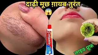 Stop Shaving😱बस ये मामूली सी चीज यूज़ करते ही दाढ़ी,मूंछ साफ || facial hair removal at home