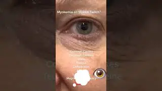 Myokymia...#sciencefacts #science #health #eye#biology #facts #factsinhindi #shorts #youtubeshorts