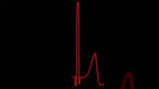 Polygraph & Voice Stress Analysis