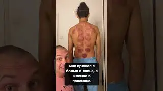 What a result can be after a cupping massage! Diagnostics after vacuum therapy!