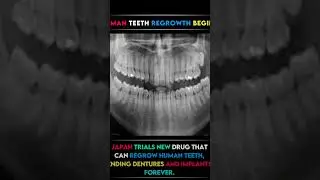 Japan starts frist ever human trial for tooth regrowth drug #scienceexperiment #recentresearch