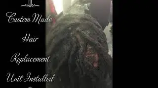 Loc Hair Replacement Video