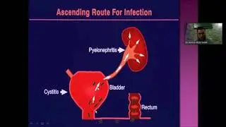 MS Urology Online Presentations: Urinary Tract Infection