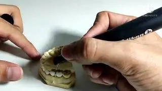 Gancho bola