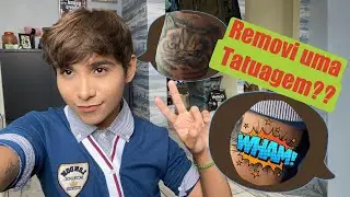 É POSSÍVEL REMOVER TATUAGEM?Antes e depois da remoção-ThiizeL