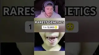 Rarest human genetics! 🤯