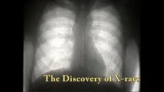 Discovery of X-rays