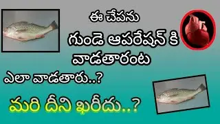 #croakerfish#heartoperation#fish#ఈ చేపను గుండె ఆపరేషన్ సమయంలో ఎందుకు ఉపయోగిస్తారు#baluwithyou